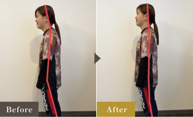 骨盤の歪みが整い、普段の立ち姿勢からバランスの取れた姿勢に